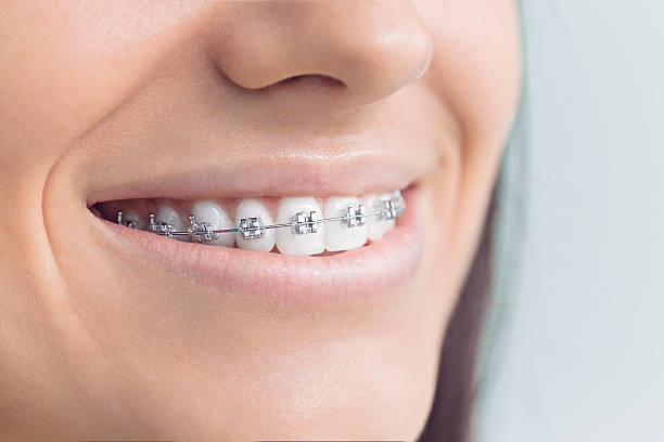 Best Veneers and Lumineers  in Basin, WY